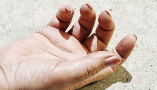 H�rom �ve elt�nt magyar n� holttest�t tal�lt�k meg Londonban egy fagyaszt�ban